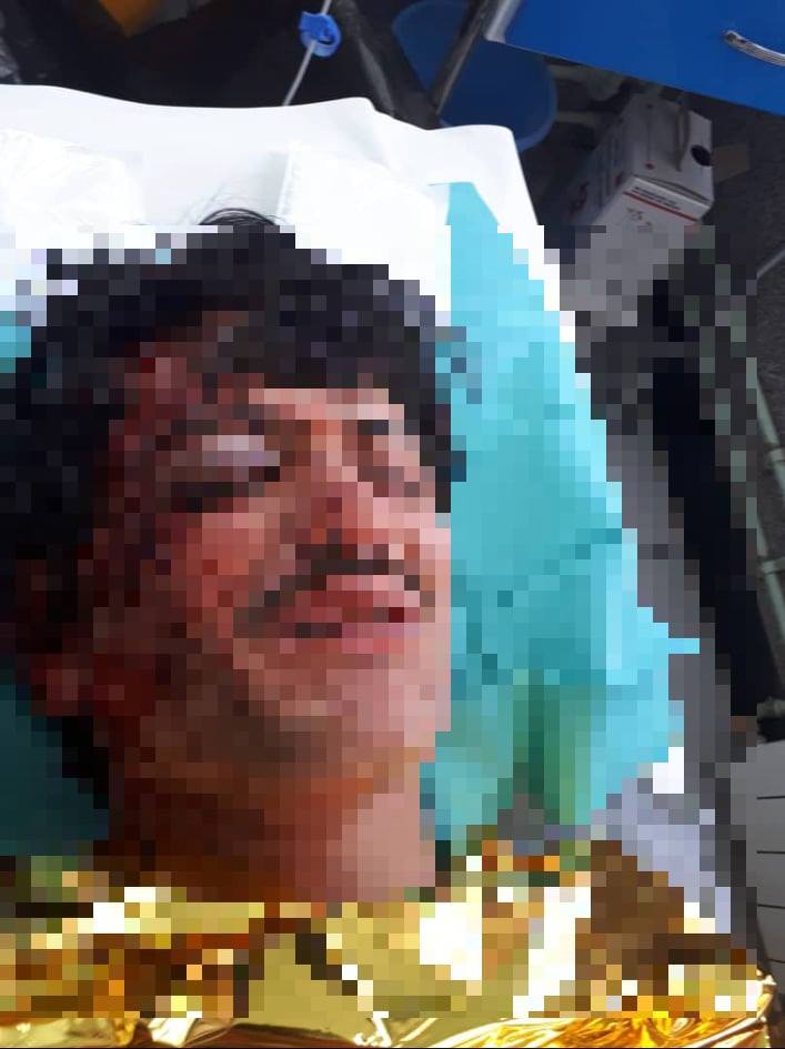 moi